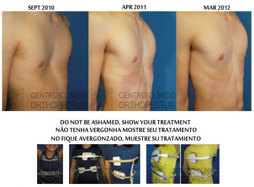 Dynamic-Remodeling-Before-and-After